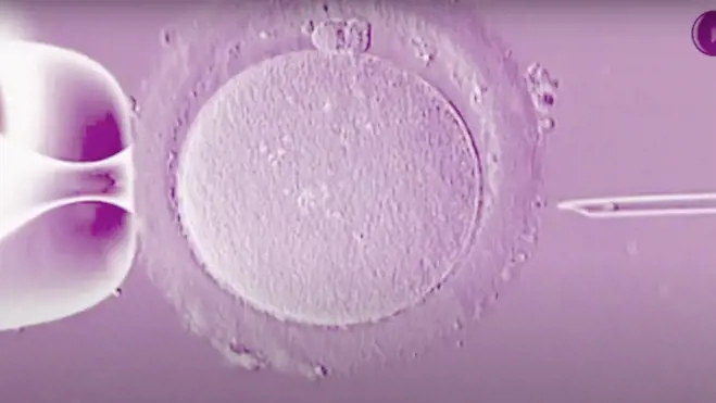 Human egg cell held by a micropipette as a fine needle approaches for microinjection during IVF under a microscope.