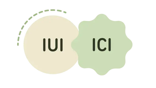 Illustration comparing IUI and ICI treatment with donor sperm